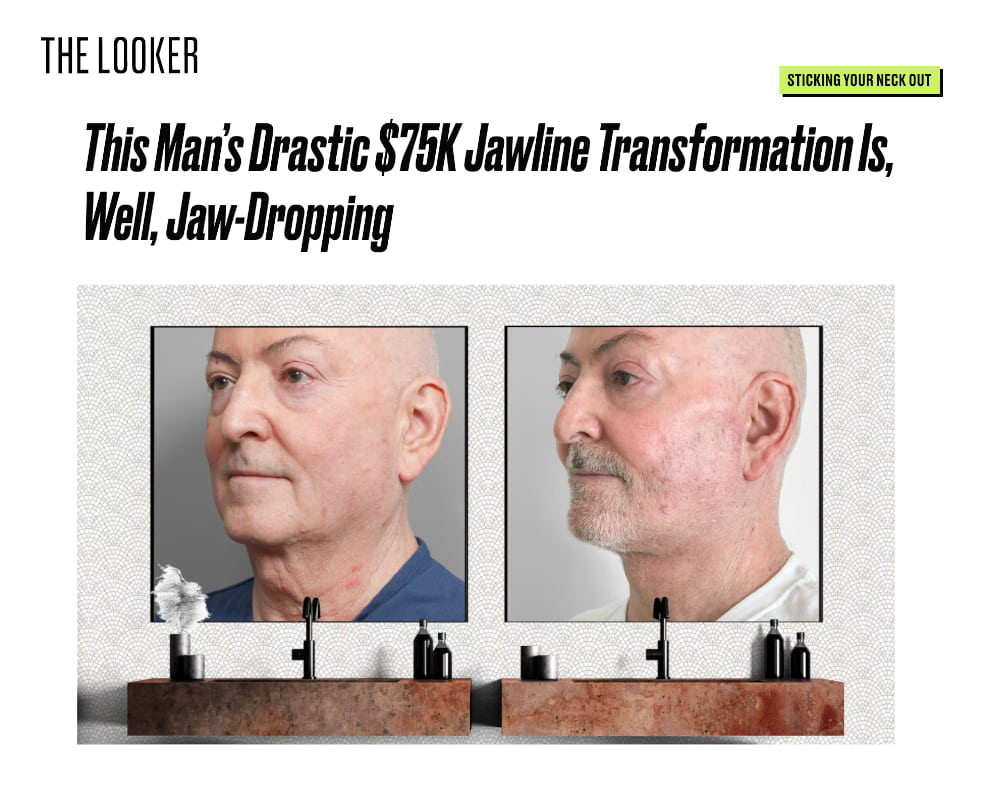 Plastic Surgery article